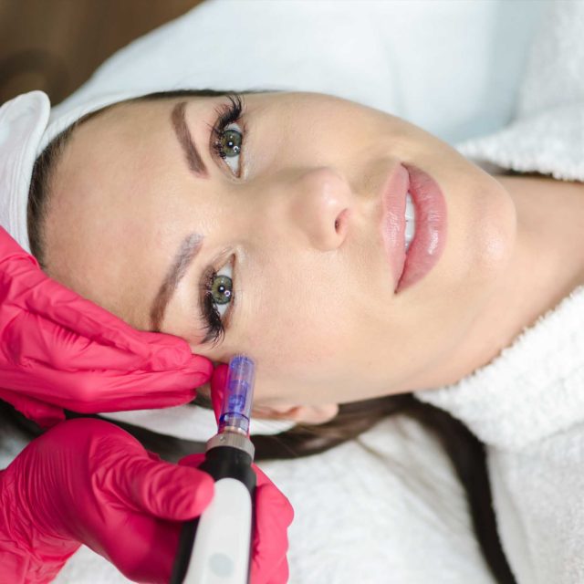 https://fbdivineskin.ch/wp-content/uploads/2020/09/microneedling-square-640x640.jpg